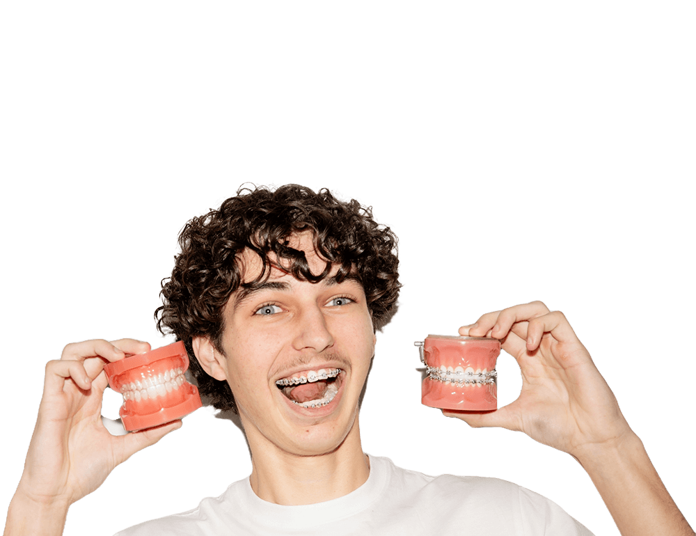braces-01.png